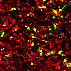 Fluorescent Biosensors Reveal the Inner Workings of Living Cells