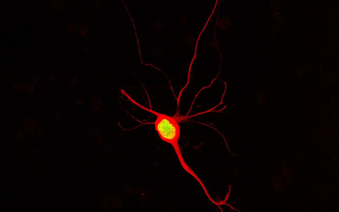 Expression in iPSC Derived Neurons